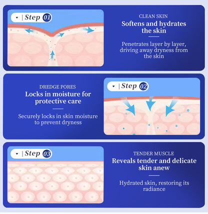 Crème à 40 % d'urée - Spécialement conçue pour l'hyperkératose, l'ichtyose, le psoriasis et l'eczéma 