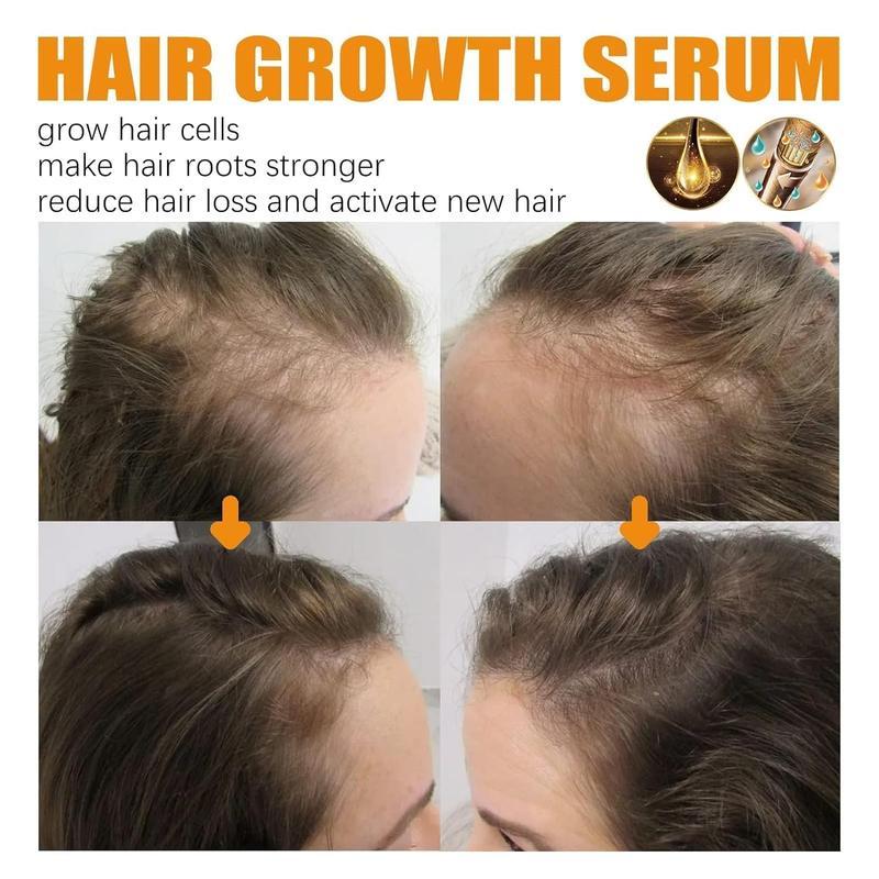 Stimulateur de cuir chevelu au gingembre | Sérum pour la pousse des cheveux 