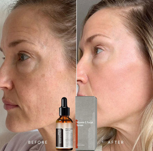 Vitamin C Spot-Removing Serum: Comprehensive Skin Improvement – Natural Anti-Aging Solution