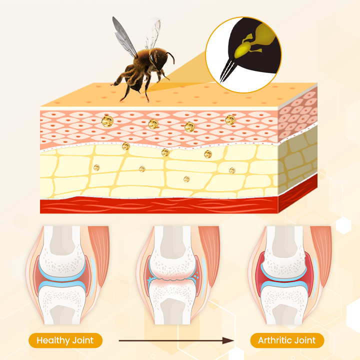 OrthoRestore Bee Venom Joint Relief Cream