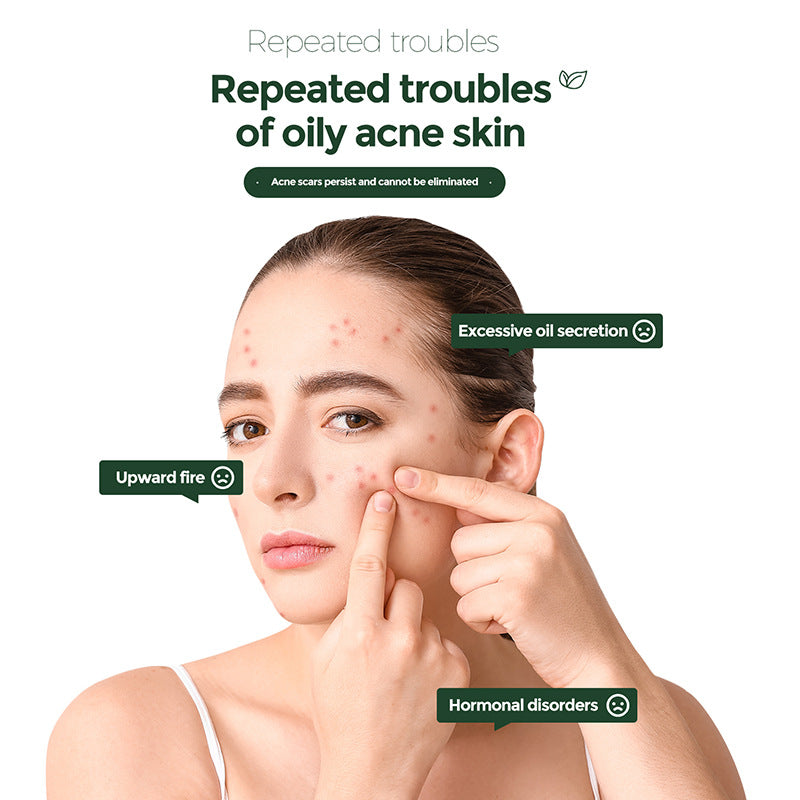 Salicylic Acid Acne Cream - Professional Blemish Mark Repair