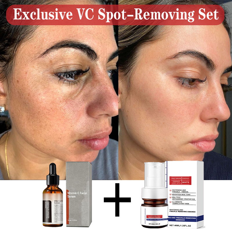 VC Spot-Removing Serum ✚ VC Whitening Freckles Face Cream (Set)