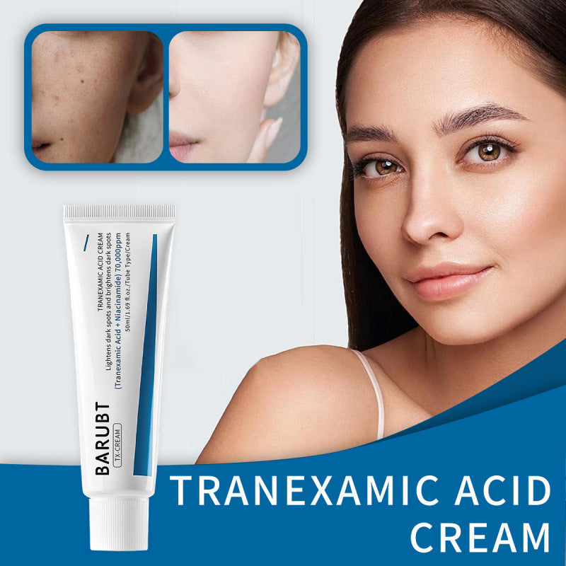 TX Tranexamic Acid CREAM | Skin freckle Cream, Blemishes, Anti-pigmetation